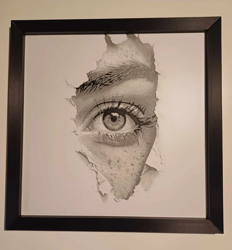 Eye