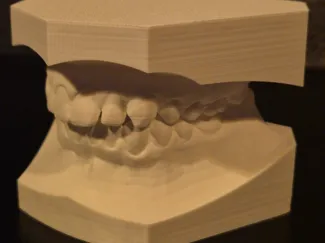 Dentalmodell