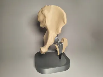 Modelo para impresión 3D: Hip Replacement Anatomy Model — vista de referencia 3
