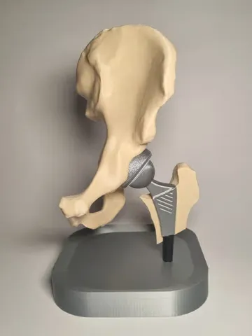 Modelo para impresión 3D: Hip Replacement Anatomy Model — vista de referencia 2