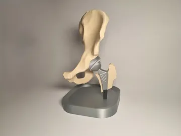 Modelo para impresión 3D: Hip Replacement Anatomy Model — vista de referencia 5