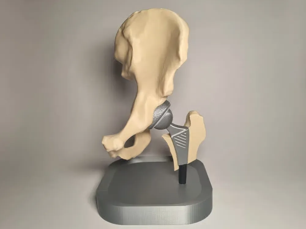 Modelo para impresión 3D: Hip Replacement Anatomy Model. Referencia del modelo original.