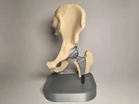 Modelo para impresión 3D: Hip Replacement Anatomy Model — referencia de MakerWorld