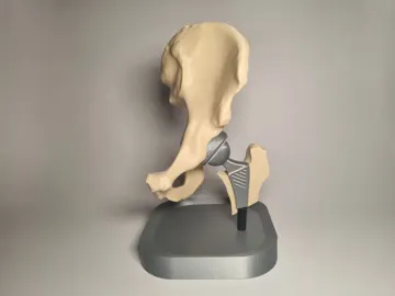 Modelo para impresión 3D: Hip Replacement Anatomy Model — vista de referencia 4