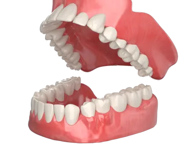 Tooth model