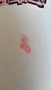 A separate set of rings