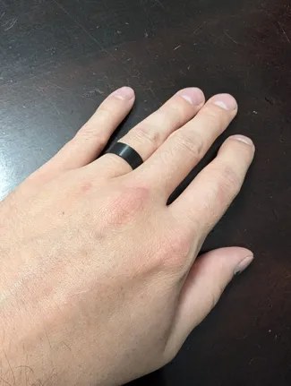 Simple Ring