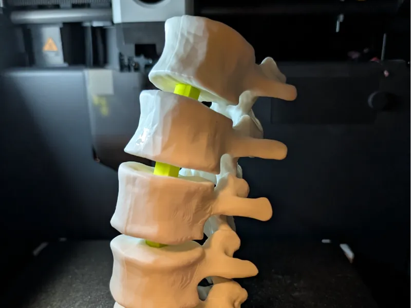 Articulating Lumbar Vertebrae 
