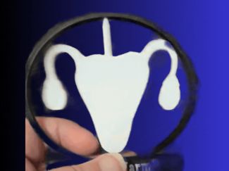 Spinning Uterus