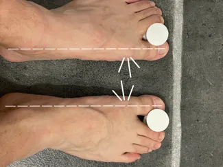 toes stretcher for exercises against flat feet