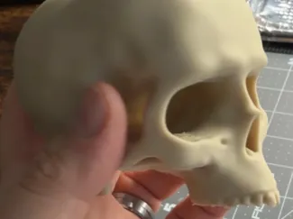 Human Skull