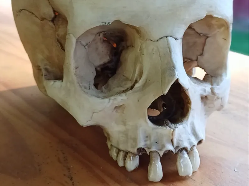 Skull with separate teeth