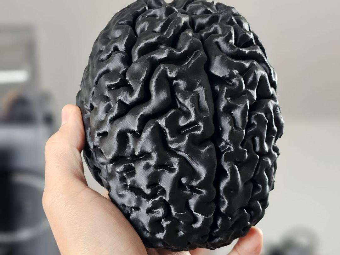 My Brain - Real Human Brain 1:1 Scale -with Lesion